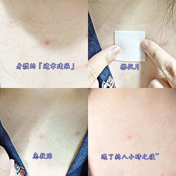 ACROPPASS肌膚急救貼(6組1盒)34.jpg